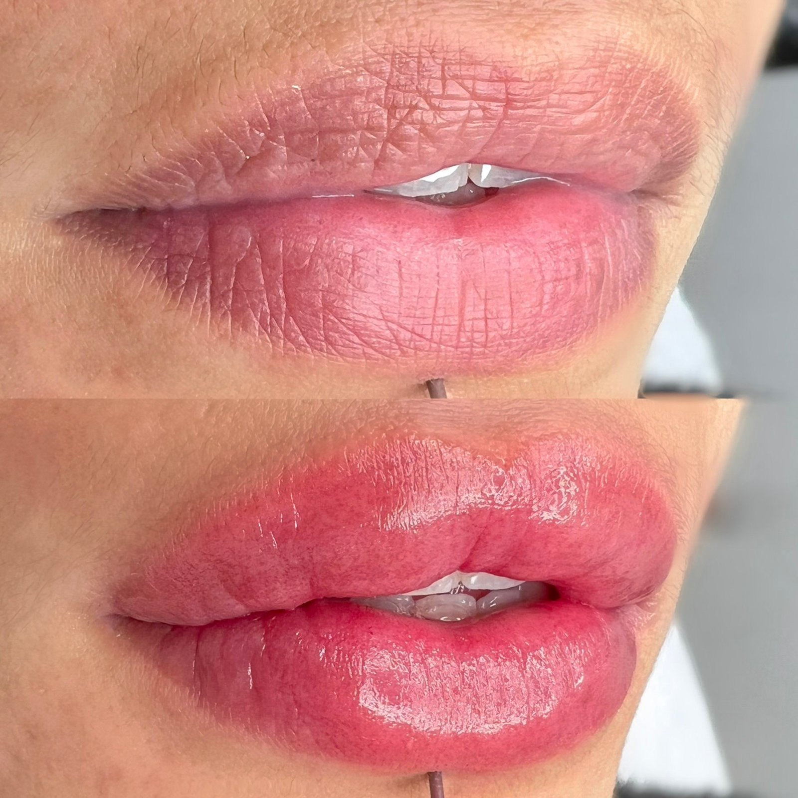 10-Facetune_21-09-2022-11-40-51