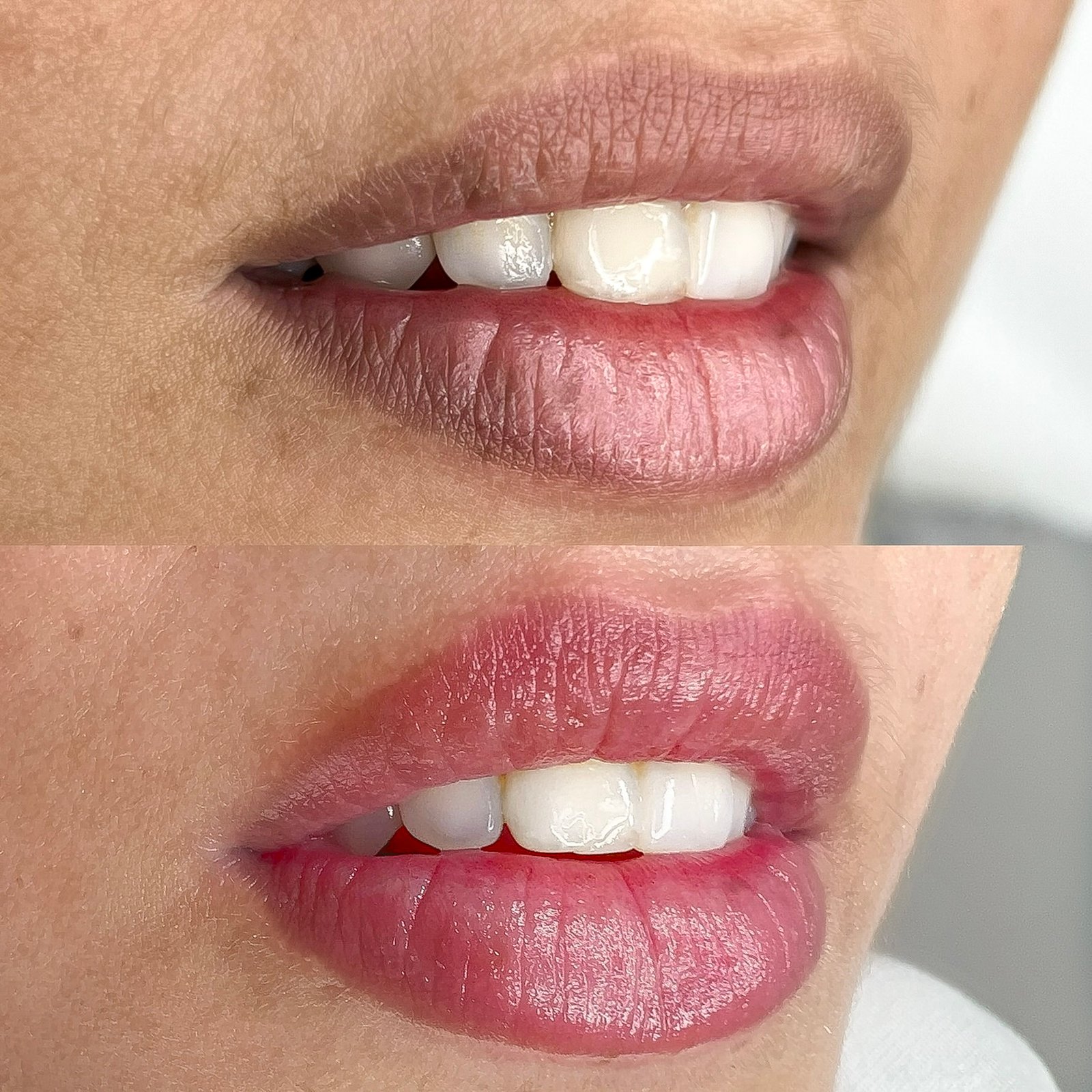 14-Facetune_18-09-2022-15-55-02 (1)