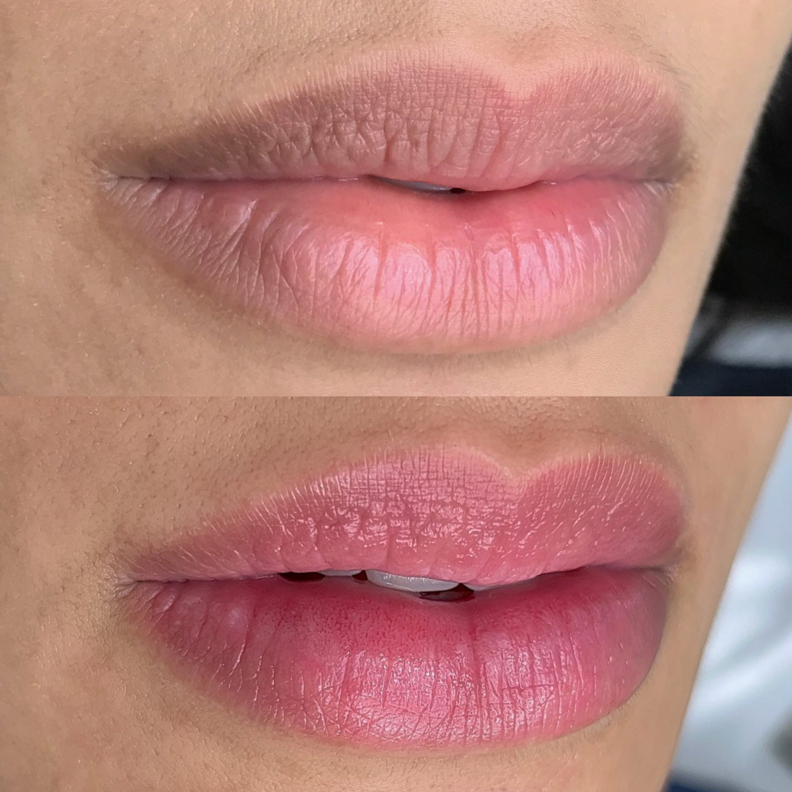 Cópia de Facetune_25-09-2022-20-53-42