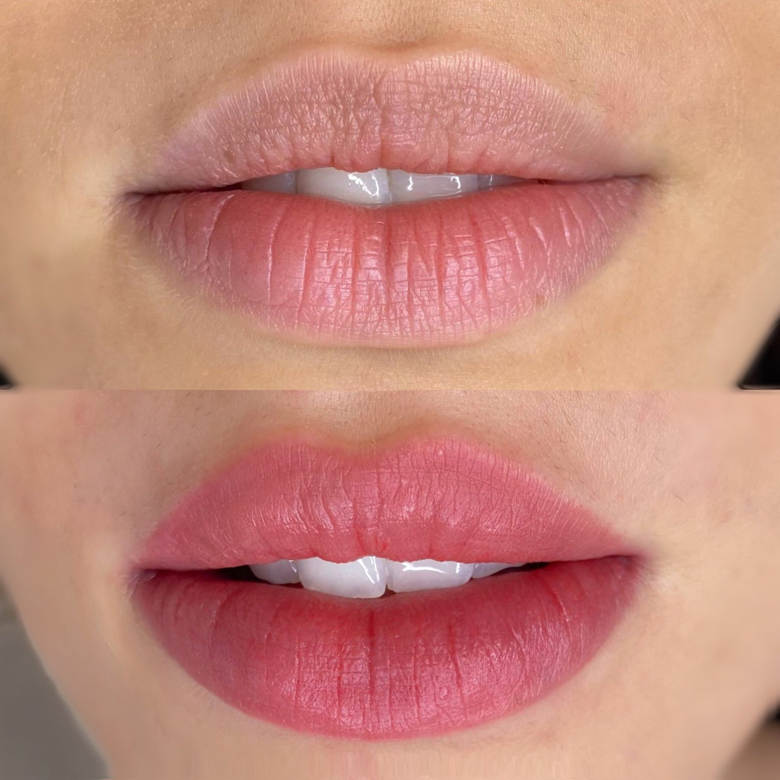 Facetune_08-02-2025-11-14-16