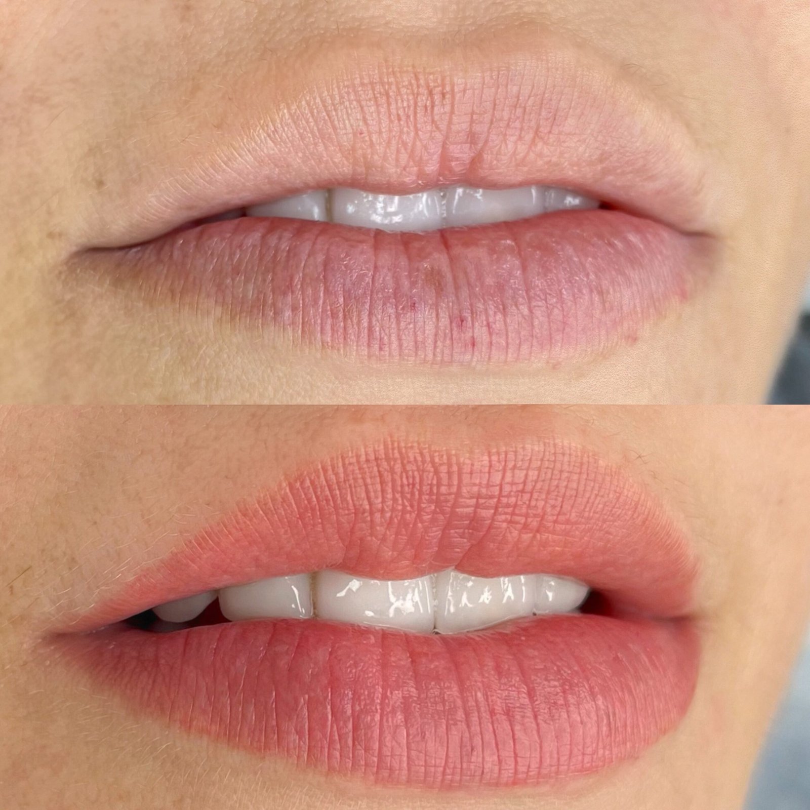 Facetune_11-09-2024-18-35-22