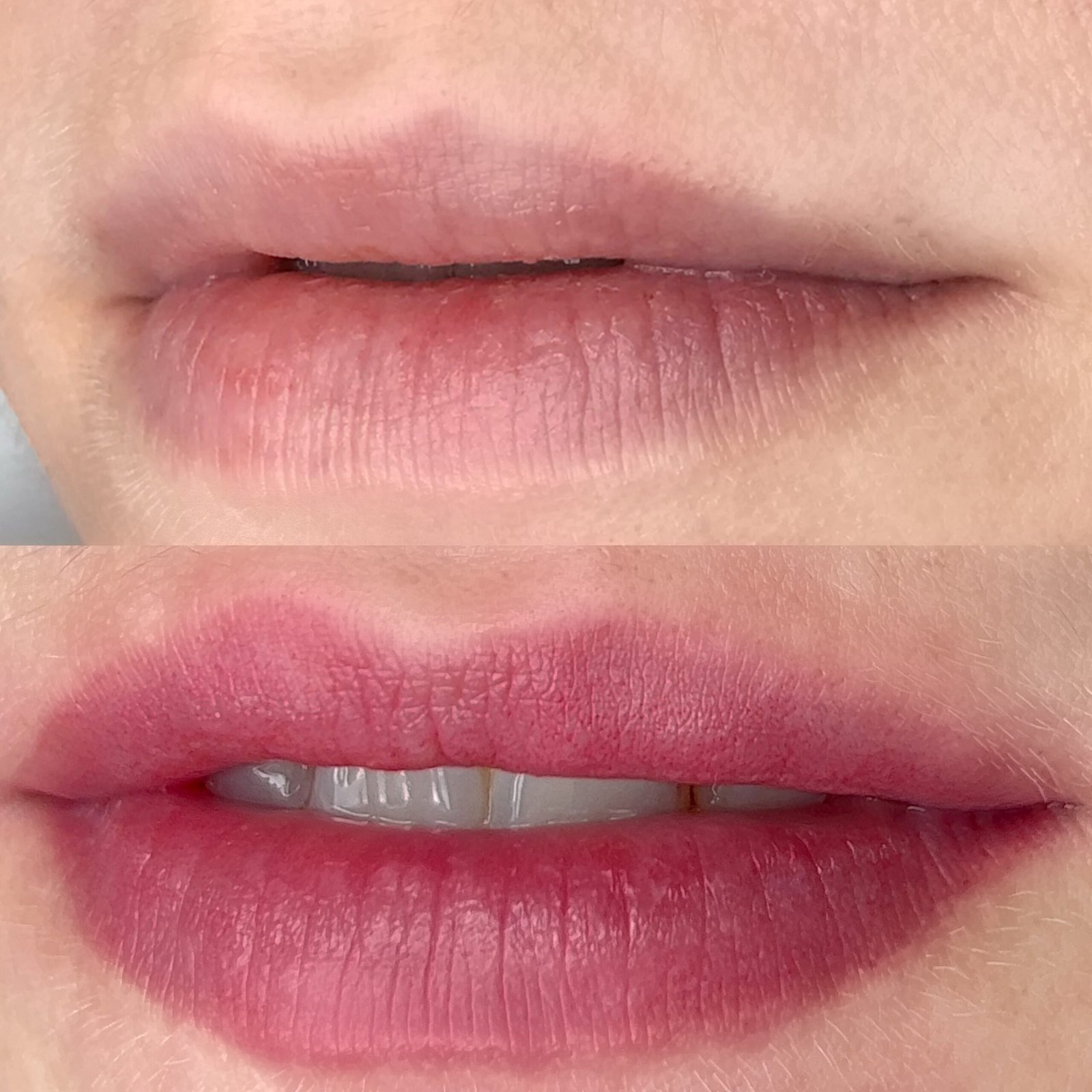 Facetune_22-09-2022-14-34-06